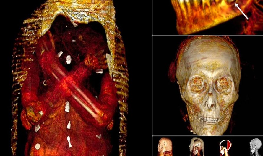 Discovering the ‘Golden Boy’ Mummy: Ancient Teenager Laid to Rest with 49 Amulets, Including a Unique Placement – New Study Unveils Secrets